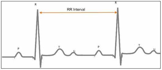 HRV 1.png